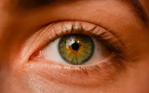 Occhio con iride verde-ambra, riflessi nella pupilla. Potrebbe essere un'immagine legata a iniezione intravitreale effetti collaterali.