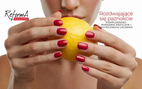 Dłonie z czerwonymi paznokciami trzymają cytrynę. Tekst informuje o rozdwajaniu się paznokci i sposobach leczenia.