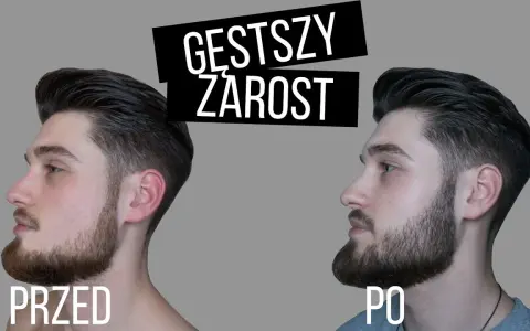 Jak przyspieszyć zarost? Ekspert radzi, co naprawdę działa.