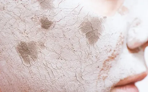 Textura agrietada de una mascarilla de arcilla sobre la piel, mostrando cómo protege la barrera cutánea.