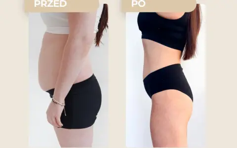 Przed i po: widoczna metamorfoza sylwetki, która pokazuje, jak schudnąć 5 kg.
