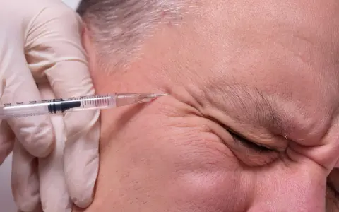 Kwas hialuronowy: Jak wstrzyknąć bezpiecznie? Tylko u lekarza!