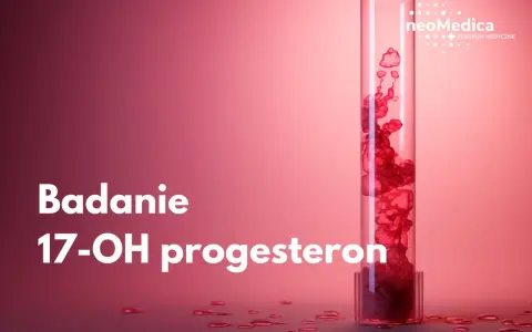 Badanie 17-OH progesteron. Podwyższony poziom może wiązać się z objawami takimi jak trądzik czy nadmierne owłosienie.