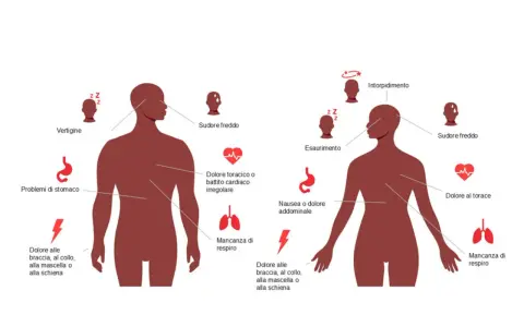 Sintomi infarto da stress: vertigini, sudore freddo, dolore toracico, nausea, intorpidimento, dolore a braccia/collo/mascella/schiena.