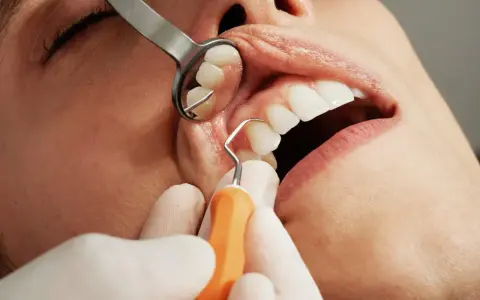 Dentysta wykonuje skaling zębów, używając narzędzi i lusterka.