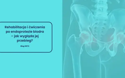 Kiedy rehabilitacja po endoprotezie kolana? Pełny plan powrotu!