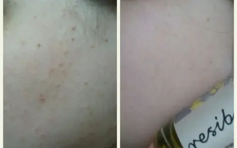 Resibo Kontrola Sebum: Czy to serum rozwiąże Twoje problemy z cerą?