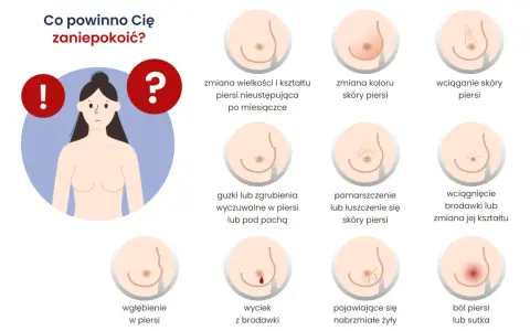 Grafika pokazuje objawy, które mogą świadczyć o tym, jak szybko rośnie guz w piersiach: zmiany skórne, guzki, wyciek z brodawki, ból.