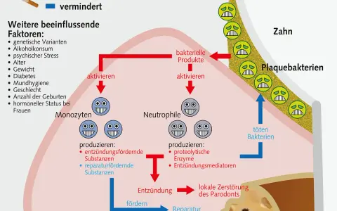 Das Diagramm zeigt, wie sich das Zahnfleisch nach Rauchstopp regeneriert. Es erklärt die Rolle von Monozyten und Neutrophilen bei Entzündung und Reparatur.