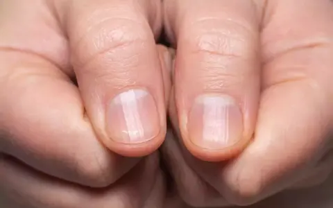 Des ongles fragiles ? Découvrez comment durcir les ongles recette de grand-mère pour des mains sublimes.