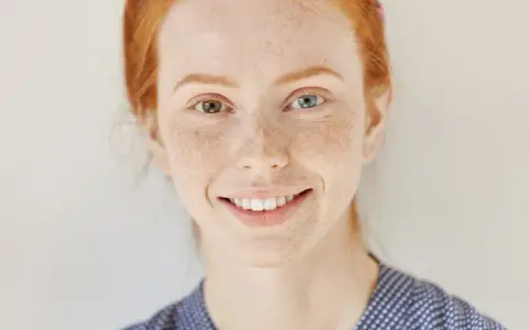 Ruda dziewczyna z piegami i różnymi kolorami oczu – przykład heterochromii.