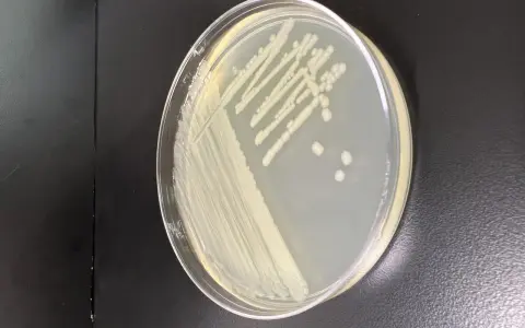 Colonia di batteri su piastra di Petri, forse Pseudomonas putida, con crescita a strisce e colonie isolate.
