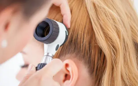 Un dermatologo esamina il cuoio capelluto con un dermatoscopio, eseguendo un pull test per valutare la caduta dei capelli.