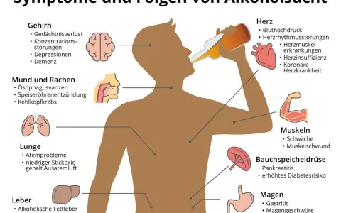 Illustration zeigt Symptome von Alkoholsucht: Gehirn, Herz, Lunge, Leber, Magen, Bauchspeicheldrüse, Muskeln, Mund & Rachen. Die 10 Stufen des Alkoholismus sind hier nicht dargestellt.