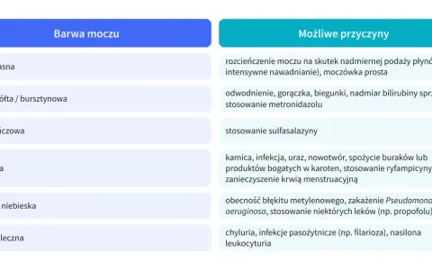 Tabela przedstawia kolory moczu i ich możliwe przyczyny, np. skąpomocz objawy mogą być związane z odwodnieniem.