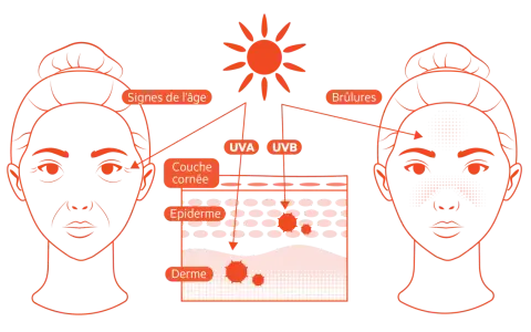 Le soleil émet des rayons UVA et UVB qui causent des signes de l'âge et des brûlures sur la peau.