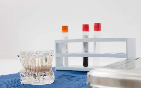 Model szczęki z implantami, probówki i sterylne pudełko. Precyzyjny konturing zębów w gabinecie stomatologicznym.