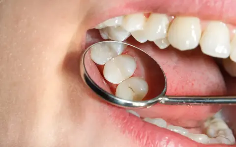 Znieczulenie u dentysty: czy jest bezpieczne? Fakty i mity