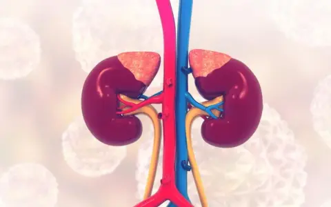 Anatomia nerek z naczyniami krwionośnymi. Grafika może sugerować stan zapalny, wpływający na ropień nerki rokowania.