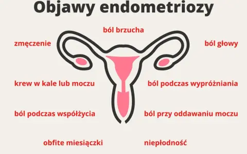 Objawy endometriozy: ból brzucha, zmęczenie, krew w kale lub moczu, ból głowy, ból podczas wypróżniania, ból podczas współżycia, ból przy oddawaniu moczu, obfite miesiączki, niepłodność.