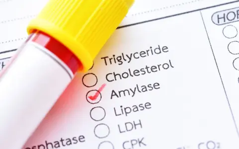 Esame del sangue con provetta e modulo di analisi. La casella "Amylase" è spuntata, indicando un controllo dei valori normali di amilasi.