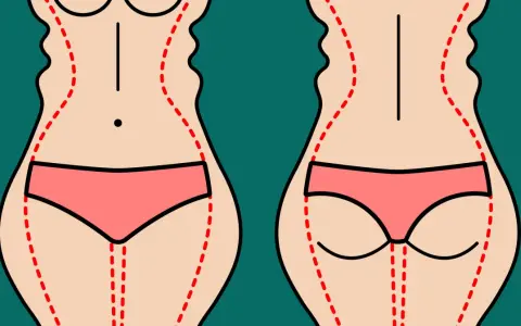 Ilustracja pokazuje sylwetki z zaznaczonymi liniami, sugerującymi zabieg. Warto znać liposukcja kawitacyjna przeciwwskazania.