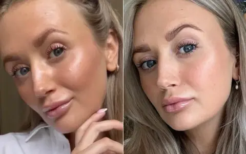 Kobieta z błyszczącymi ustami i rozświetloną cerą, inspirowana stylem Hailey Bieber.