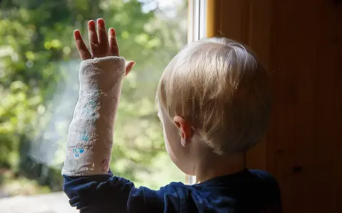 Kind mit Gips am Arm, das durch ein Fenster schaut. Ein gebrochenes Handgelenk bei einem Kind ist schmerzhaft, aber die bunte Gipsbinde macht es erträglicher.