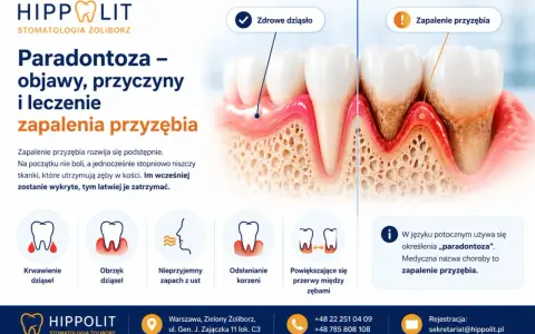 Zapalenie przyzębia: objawy to krwawienie, obrzęk dziąseł, nieprzyjemny zapach, odsłonięte korzenie i przerwy między zębami. Wczesne wykrycie kluczowe.