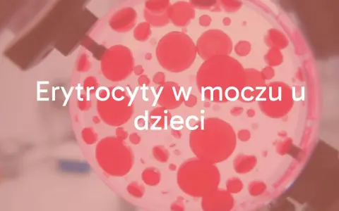 Badanie moczu: ogólne czy posiew? Zrozum różnice i diagnozę