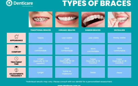 Porównanie aparatów ortodontycznych: tradycyjne, ceramiczne, Damon i Invisalign. Zęby wysunięte do przodu mogą być korygowane.