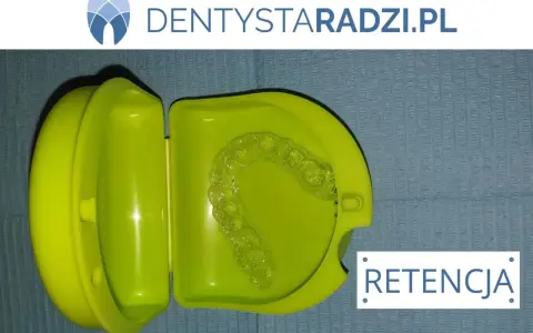 Przezroczyste nakładki na zęby po aparacie ortodontycznym w zielonym etui. Retencja dla pięknego uśmiechu.