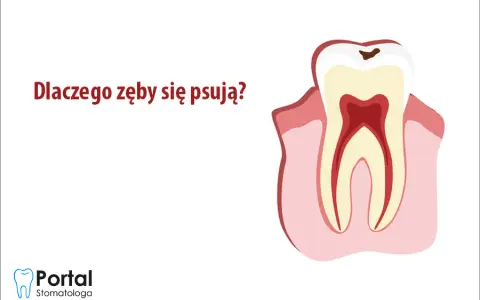 Od czego psują się zęby? Odkryj prawdziwe przyczyny i chroń uśmiech