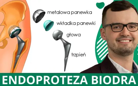 Jakie endoprotezy stawu biodrowego refunduje NFZ i ile kosztują?
