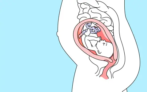 Ein Baby in der 25. SSW liegt im Mutterleib, umgeben von der Nabelschnur und der Fruchtblase.