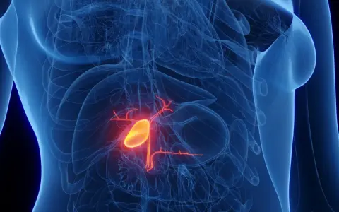 Anatomical rendering of a human torso showing the gallbladder highlighted in yellow and red, indicating potential rak pęcherzyka żółciowego.