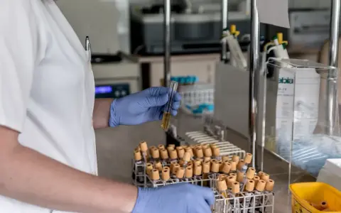 Laborantka w niebieskich rękawiczkach trzyma probówkę z żółtym płynem. W tle stoją liczne probówki i sprzęt laboratoryjny, sugerujący pracę nad analizą ccp.
