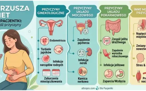 Ilustracja przedstawia przyczyny bólu brzucha i nietypowych krwawień u kobiet, od ginekologicznych po pokarmowe i inne.