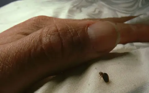 Una pequeña chinche se arrastra cerca de un dedo humano. Es una imagen inquietante que muestra el momento en que salen las chinches.