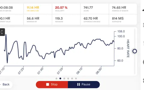 Herzfrequenz-Diagramm zeigt die HRV-Amplitude von 11.14 HR. Die Werte schwanken zwischen 56.6 und 119.3 HR.