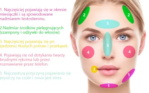 Dlaczego pryszcze wyskakują w tym samym miejscu? Sprawdź przyczyny