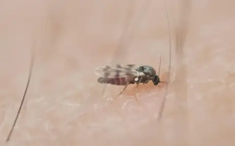 Mały meszek na skórze. Szukasz domowych sposobów na meszki? Ten owad może być uciążliwy.