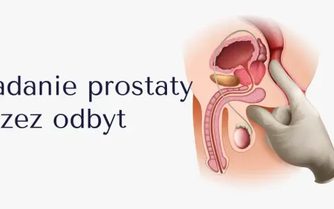 Ilustracja przedstawia badanie per rectum. Palec w rękawiczce bada prostatę, która może być wyczuwalna jako twarda.