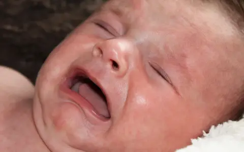 Ett kolikbarn gråter intensivt, med ögonen slutna och munnen öppen.