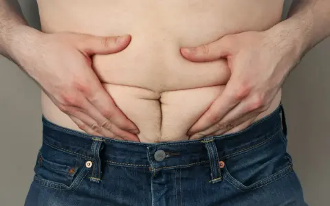Mężczyzna ściska brzuch, uwidaczniając fałdy skóry i tkankę tłuszczową, co może sugerować cellulit u mężczyzn.