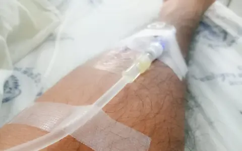 Ręka z założonym cewnikiem dializacyjnym, widoczna jest taśma medyczna i fragment pościeli szpitalnej. Pielęgnacja cewnika dializacyjnego jest kluczowa.
