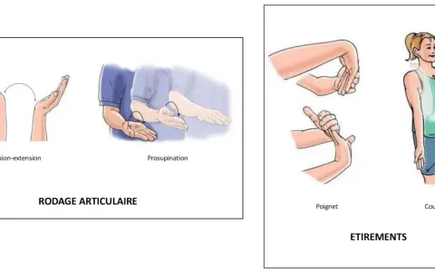 Exercices de mobilisation du poignet et du coude pour un épicondylite traitement naturel.