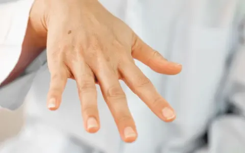 Una mano con algunas manchas, incluyendo un lunar visible en el dorso.