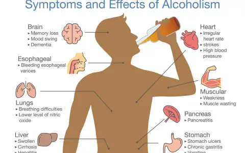 Ilustracja pokazuje, że alkohol to trucizna, która wpływa na mózg, serce, płuca, wątrobę, trzustkę i żołądek, powodując różne schorzenia.
