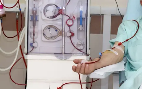 Dializator to urządzenie do prowadzenia terapii oczyszczającej krew. Pacjent podłączony do maszyny, widoczna jego ręka z kaniulą i czerwonymi przewodami.